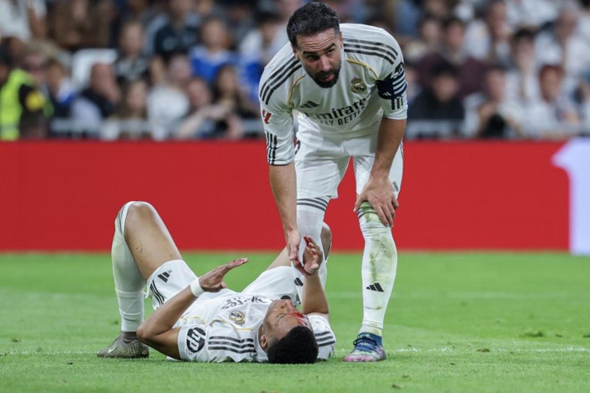 Real Madrid's French forward #10 Kylian Mbappe (L) lies on the pitch with blood on his face after colliding with Girona's Brazilian defender #12 Vitor Reis (not pictured) as Real Madrid's Spanish defender #02 Dani Carvajal assists during the Spanish league football match between Real Madrid CF and Girona FC at the Santiago Bernabeu stadium in Madrid on April 10, 2026.  Thomas COEX / AFP
